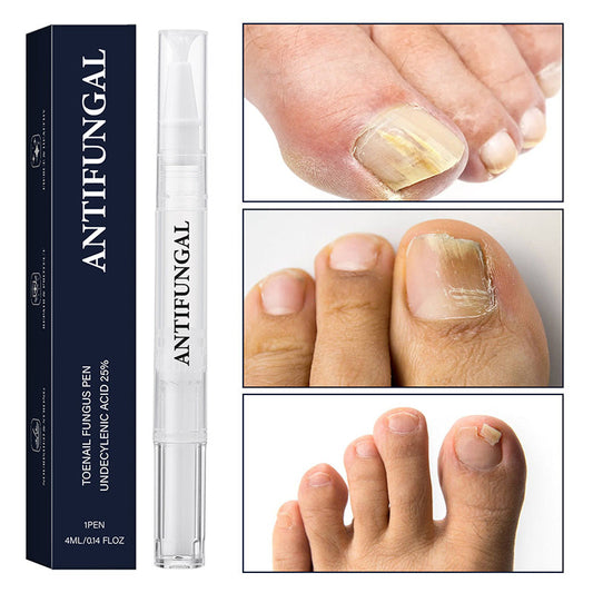 🔥Pióro do leczenia grzybicy paznokci, odpowiednie do paznokci zniszczonych✨